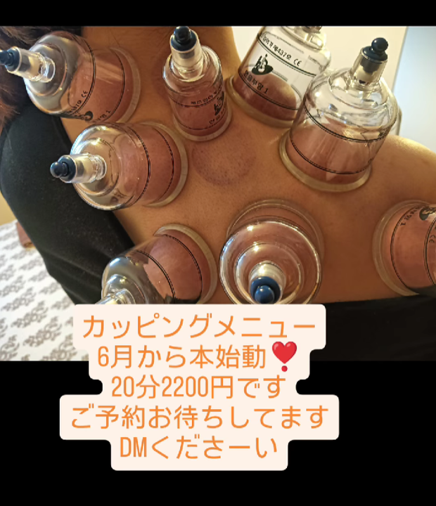 カッピング追加しました